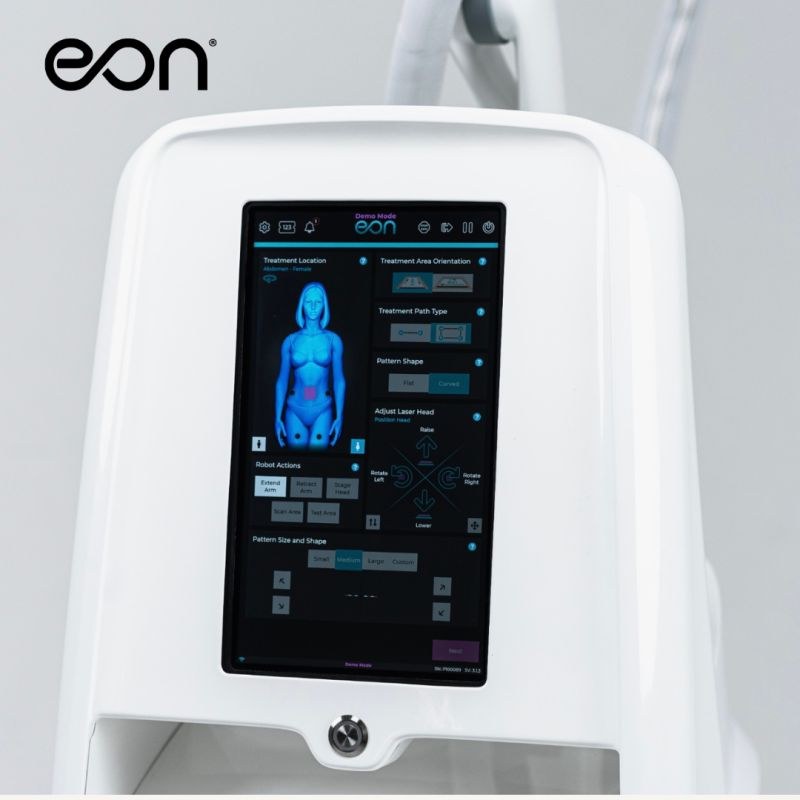 Close-up of the EON device display and white housing with the EON logo.
